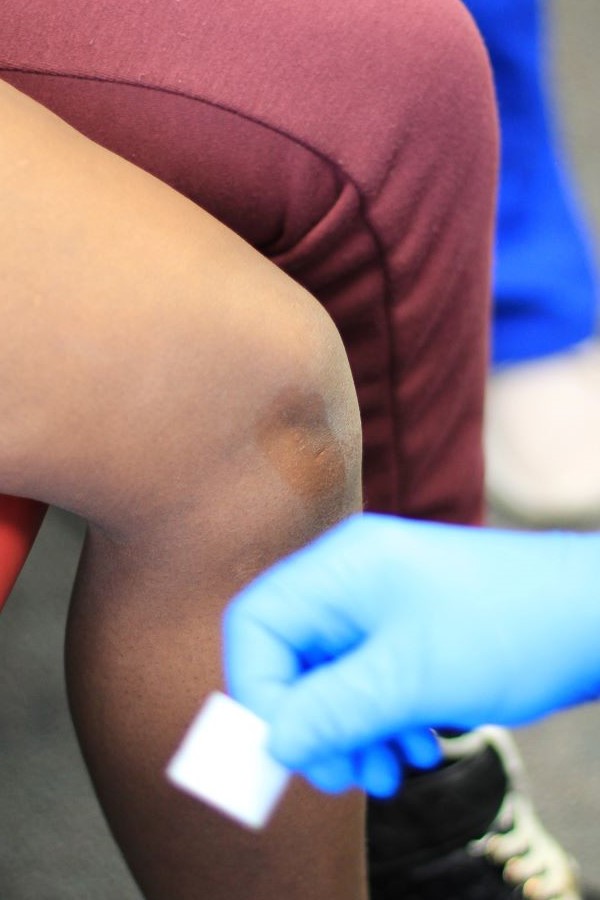 a technician holding a small piece of gauze by a knee 